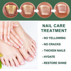 Nail Fungus Treatment Oil (Imported)