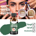 Nail Fungus Treatment Oil (Imported)