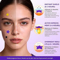 200 PCS Colorful Pimple Patches – Fast Healing Acne Spot Stickers