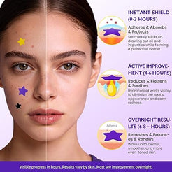 200 PCS Colorful Pimple Patches – Fast Healing Acne Spot Stickers