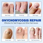 Nighttime Renewal Fungal Nail Patches