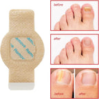 Nighttime Renewal Fungal Nail Patches