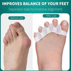 Premium Silicone Gel Toe Separators for Foot Alignment (Set of 2)