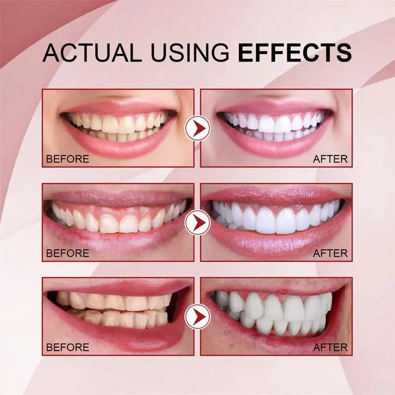 Niacinamide Whitening Toothpaste